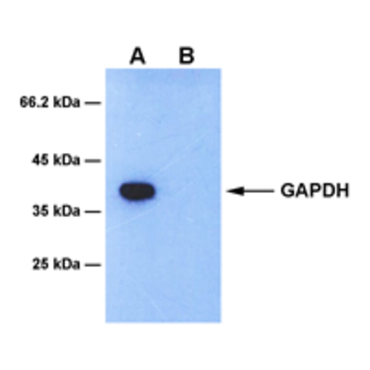Western Blot - Anti-GAPDH Antibody [4B6] (A254394) - Antibodies.com