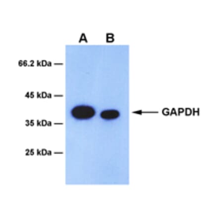 Western Blot - Anti-GAPDH Antibody [8F6] (A254395) - Antibodies.com