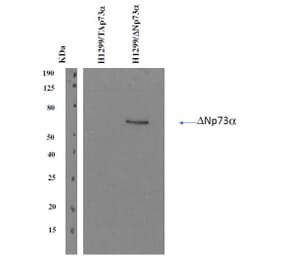 Western Blot - Anti-delta N p73 Antibody [DNp73-1.1] (A254412) - Antibodies.com