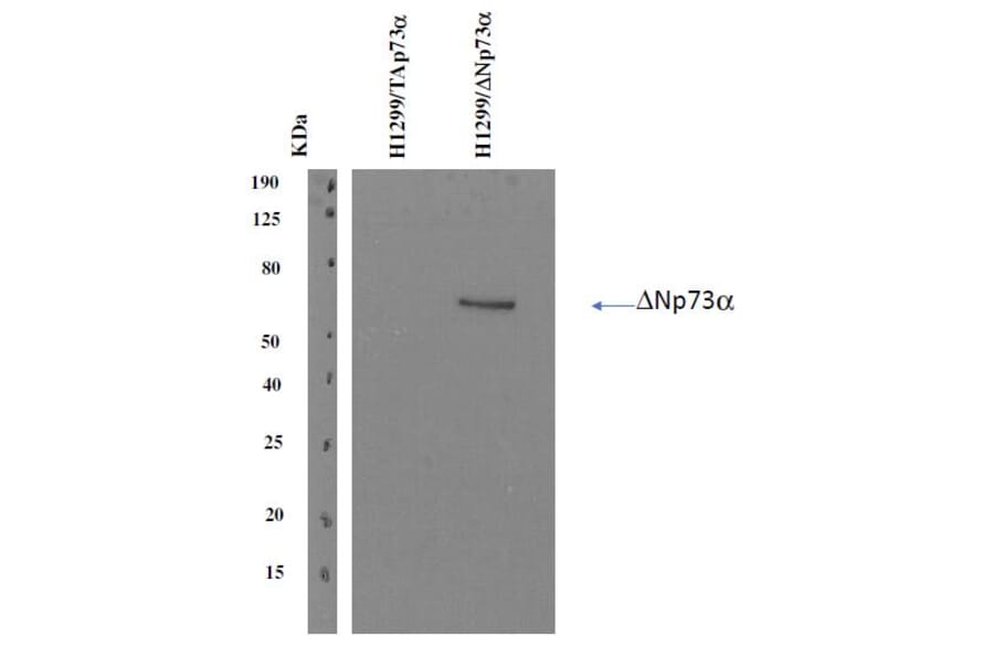 Western Blot - Anti-delta N p73 Antibody [DNp73-1.1] (A254412) - Antibodies.com