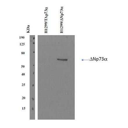 Western Blot - Anti-delta N p73 Antibody [DNp73-1.1] (A254412) - Antibodies.com