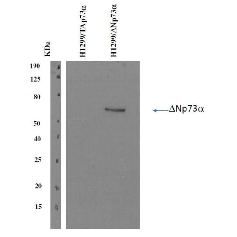 Western Blot - Anti-delta N p73 Antibody [DNp73-1.1] (A254412) - Antibodies.com