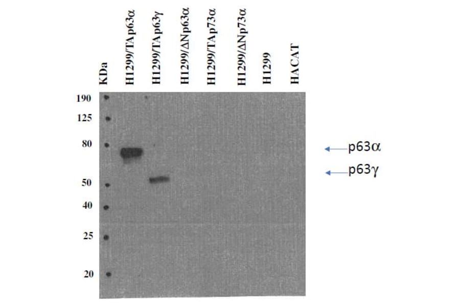 Western Blot - Anti-p63 Antibody [TAp63-4.1] (A254413) - Antibodies.com