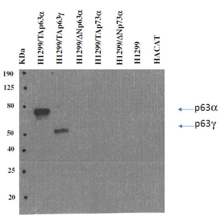 Western Blot - Anti-p63 Antibody [TAp63-4.1] (A254413) - Antibodies.com