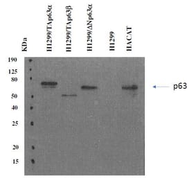 Western Blot - Anti-p63 Antibody [PANp63-6.1] (A254415) - Antibodies.com