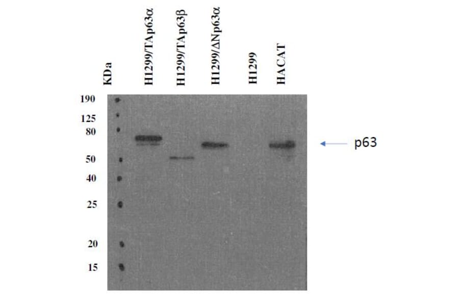 Western Blot - Anti-p63 Antibody [PANp63-6.1] (A254415) - Antibodies.com