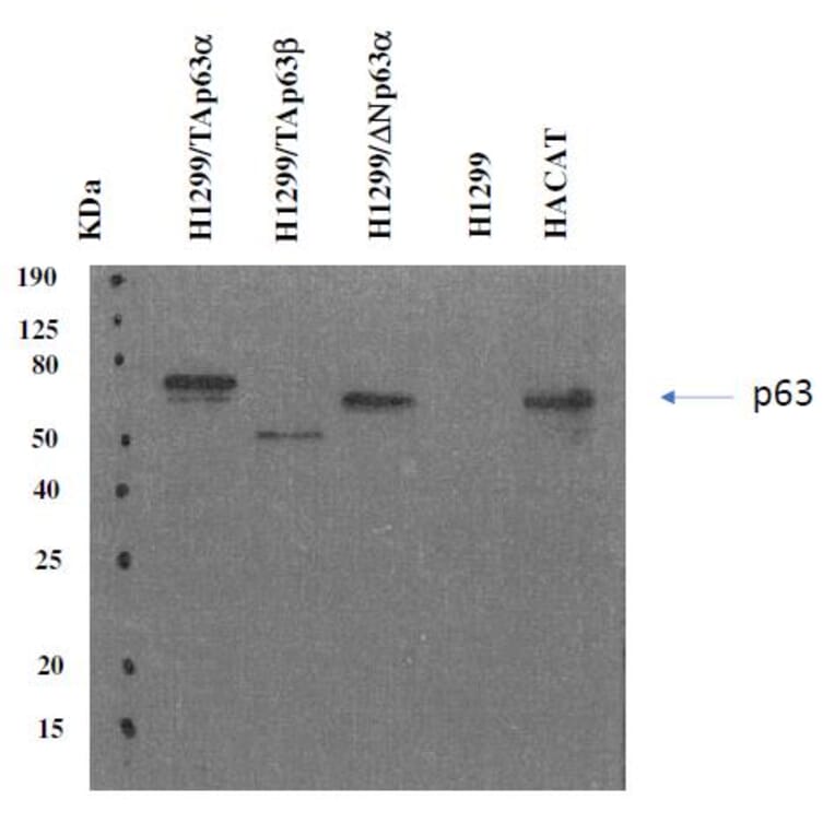 Western Blot - Anti-p63 Antibody [PANp63-6.1] (A254415) - Antibodies.com