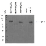 Western Blot - Anti-p63 Antibody [PANp63-6.1] (A254415) - Antibodies.com