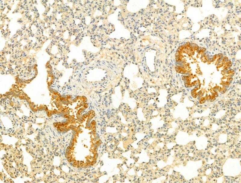 Conejo polyclonal antibody to MMP3. (A254609) | Antibodies.com