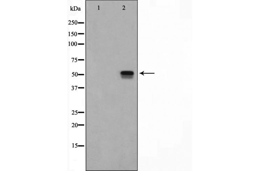 Validation Data - Anti-ETV4 Antibody (A254794)