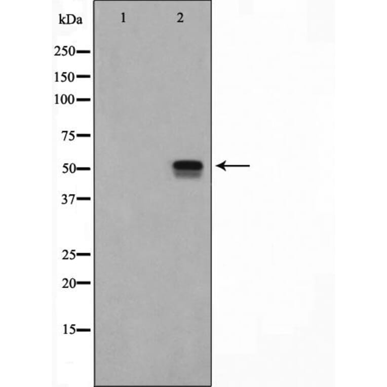 Validation Data - Anti-ETV4 Antibody (A254794)