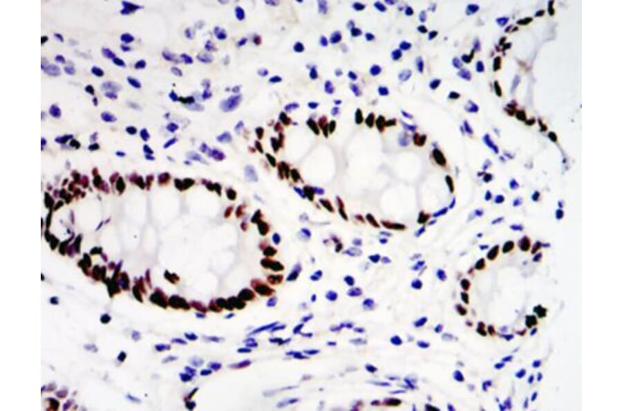Validation Data - Anti-ETV4 Antibody (A254794)