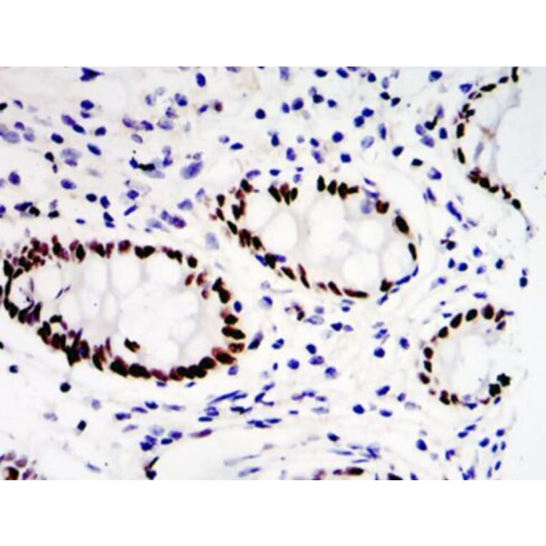 Validation Data - Anti-ETV4 Antibody (A254794)