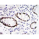 Validation Data - Anti-ETV4 Antibody (A254794)