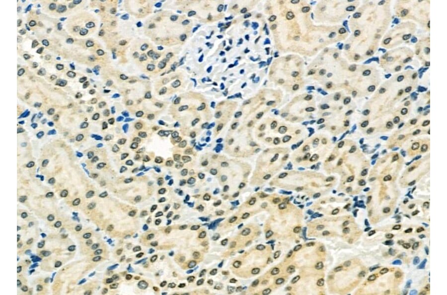 Validation Data - Anti-ETV4 Antibody (A254794)