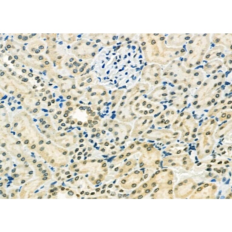 Validation Data - Anti-ETV4 Antibody (A254794)