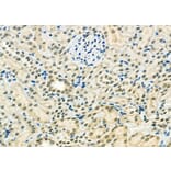 Validation Data - Anti-ETV4 Antibody (A254794)