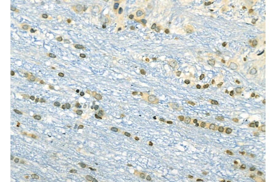 Validation Data - Anti-ETV4 Antibody (A254794)