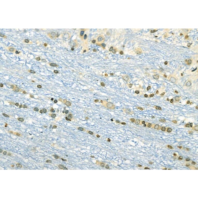 Validation Data - Anti-ETV4 Antibody (A254794)