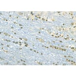 Validation Data - Anti-ETV4 Antibody (A254794)