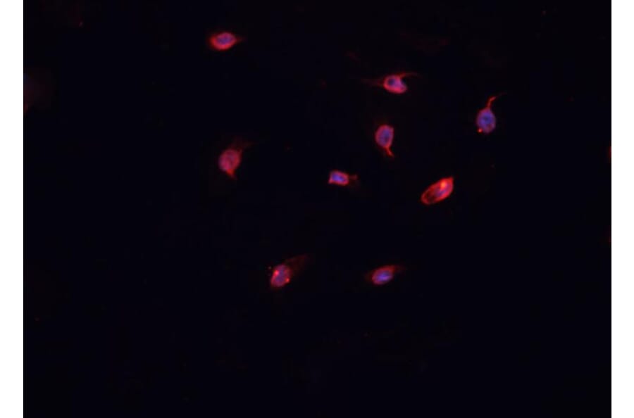 Validation Data - Anti-Collagen XII alpha 1 Antibody (A255003)