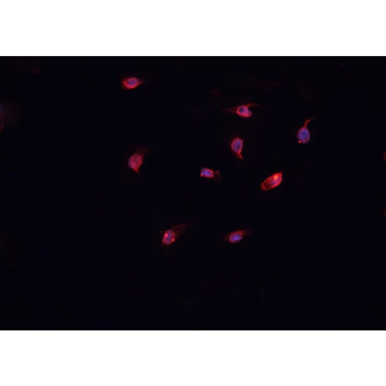 Validation Data - Anti-Collagen XII alpha 1 Antibody (A255003)