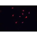 Validation Data - Anti-Collagen XII alpha 1 Antibody (A255003)