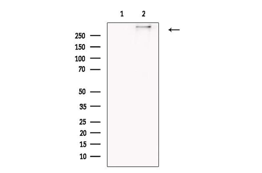 Validation Data - Anti-Collagen XII alpha 1 Antibody (A255003)