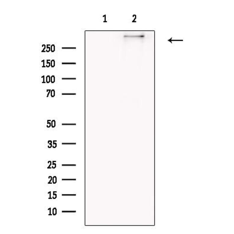 Validation Data - Anti-Collagen XII alpha 1 Antibody (A255003)