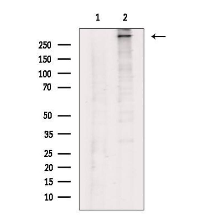 Validation Data - Anti-Collagen XII alpha 1 Antibody (A255003)