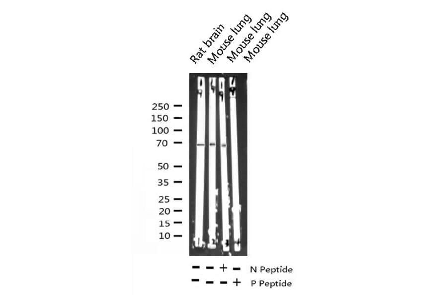 Validation Data - Anti-p70 S6 Kinase (phospho Thr252) Antibody (A255483)