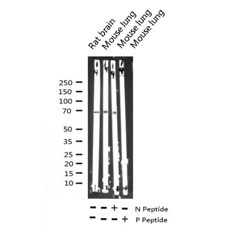 Validation Data - Anti-p70 S6 Kinase (phospho Thr252) Antibody (A255483)