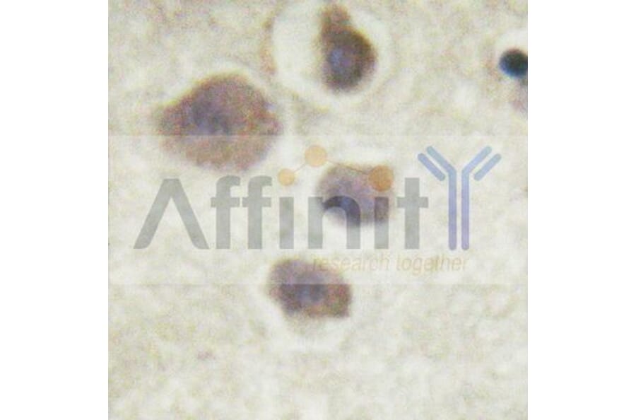 Validation Data - Anti-p70 S6 Kinase (phospho Thr252) Antibody (A255483)