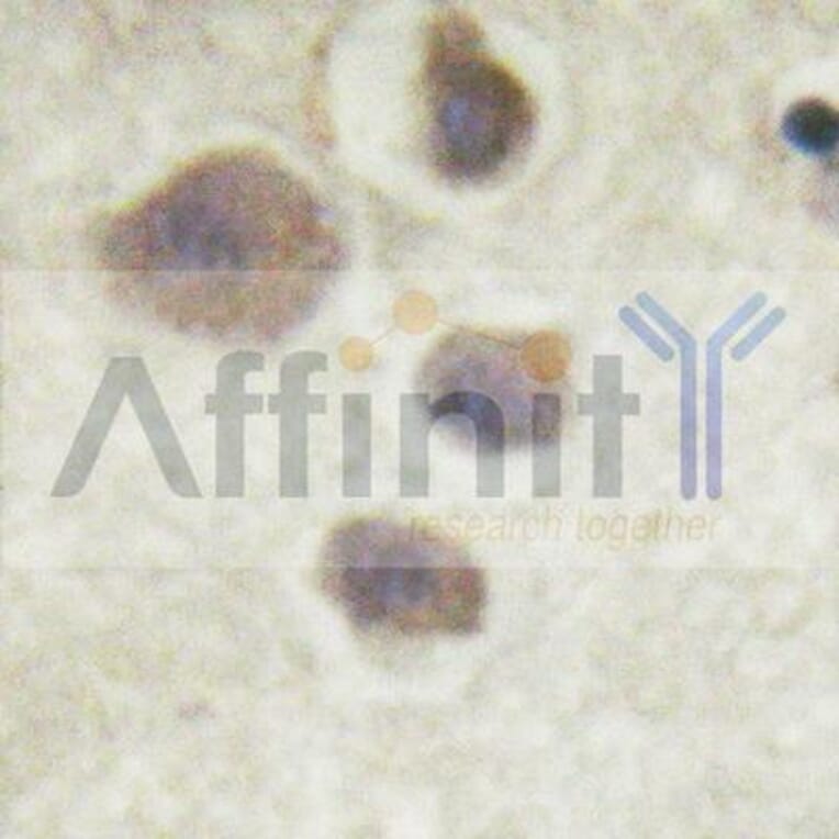 Validation Data - Anti-p70 S6 Kinase (phospho Thr252) Antibody (A255483)