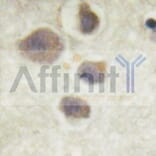 Validation Data - Anti-p70 S6 Kinase (phospho Thr252) Antibody (A255483)