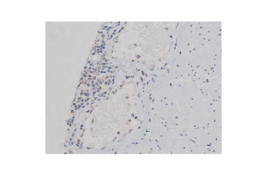 Validation Data - Anti-p70 S6 Kinase (phospho Thr252) Antibody (A255483)
