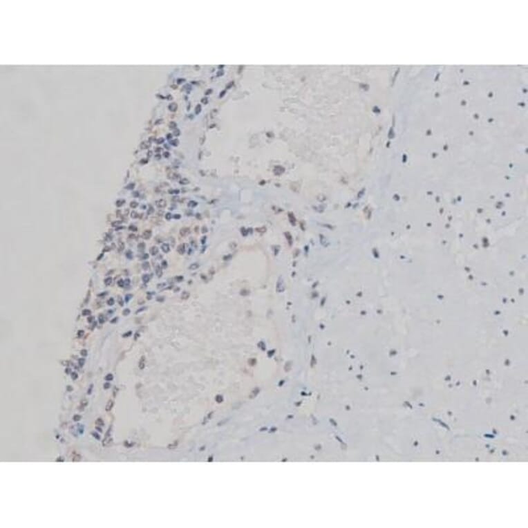 Validation Data - Anti-p70 S6 Kinase (phospho Thr252) Antibody (A255483)