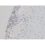 Validation Data - Anti-p70 S6 Kinase (phospho Thr252) Antibody (A255483)