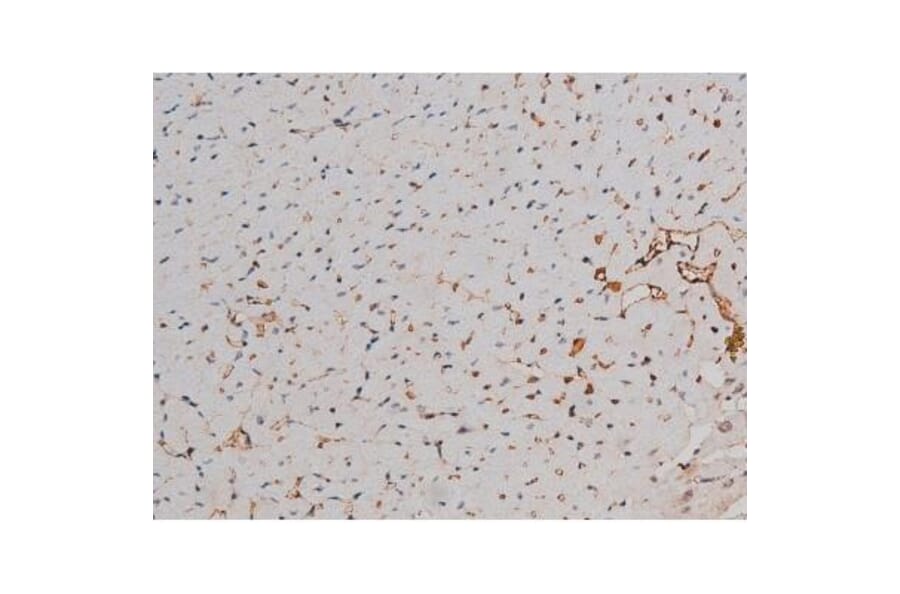 Validation Data - Anti-p70 S6 Kinase (phospho Thr252) Antibody (A255483)