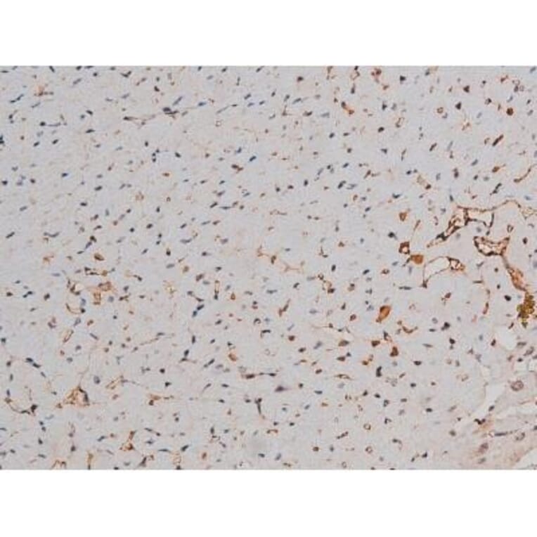Validation Data - Anti-p70 S6 Kinase (phospho Thr252) Antibody (A255483)