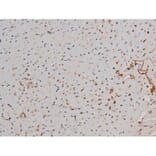 Validation Data - Anti-p70 S6 Kinase (phospho Thr252) Antibody (A255483)