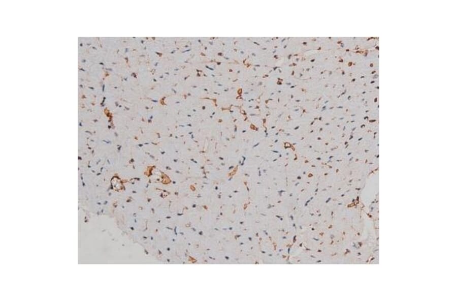 Validation Data - Anti-p70 S6 Kinase (phospho Thr252) Antibody (A255483)