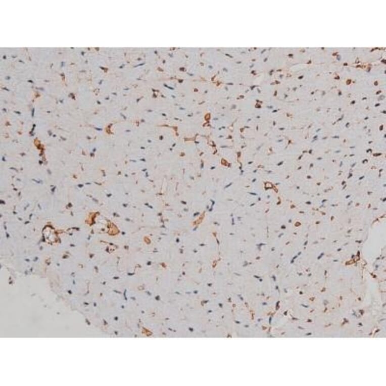 Validation Data - Anti-p70 S6 Kinase (phospho Thr252) Antibody (A255483)