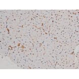 Validation Data - Anti-p70 S6 Kinase (phospho Thr252) Antibody (A255483)