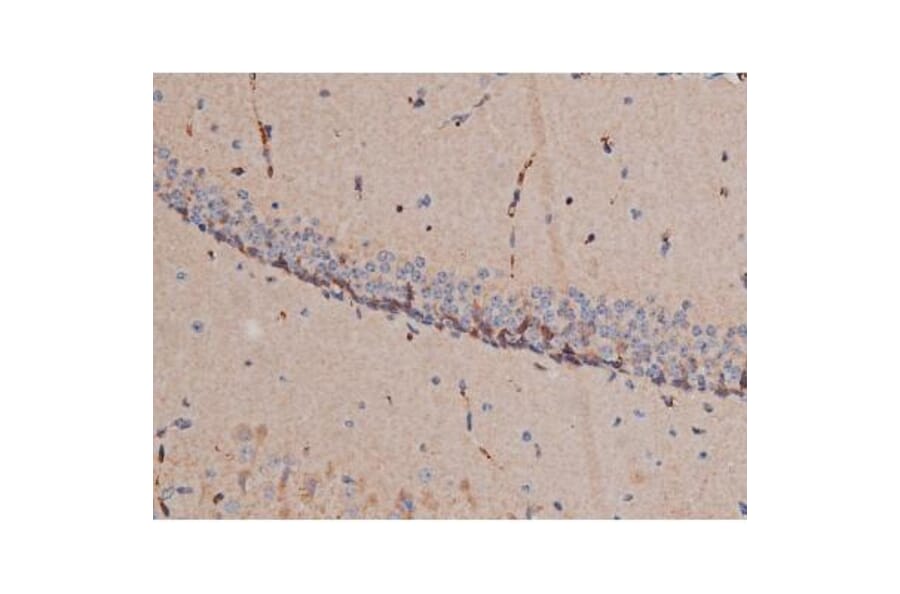 Validation Data - Anti-p70 S6 Kinase (phospho Thr252) Antibody (A255483)