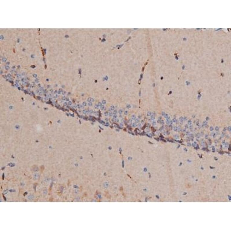 Validation Data - Anti-p70 S6 Kinase (phospho Thr252) Antibody (A255483)