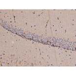 Validation Data - Anti-p70 S6 Kinase (phospho Thr252) Antibody (A255483)
