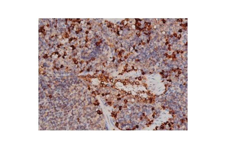 Validation Data - Anti-p70 S6 Kinase (phospho Thr252) Antibody (A255483)
