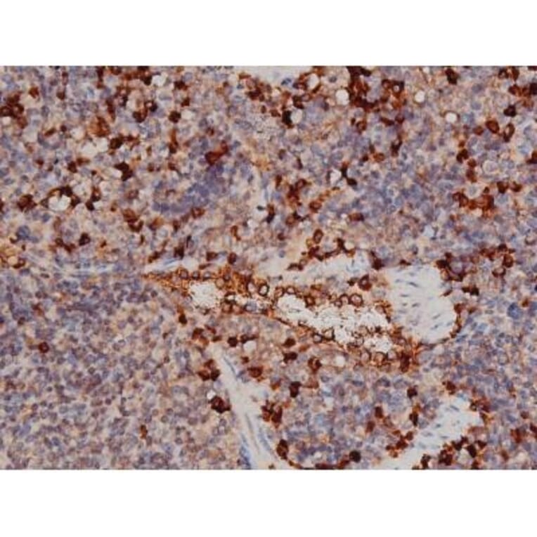 Validation Data - Anti-p70 S6 Kinase (phospho Thr252) Antibody (A255483)