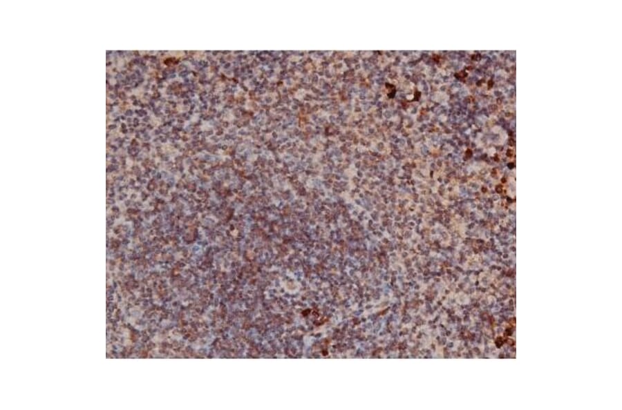 Validation Data - Anti-p70 S6 Kinase (phospho Thr252) Antibody (A255483)